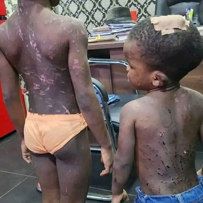 Police detain couple for physical abuse of own children 