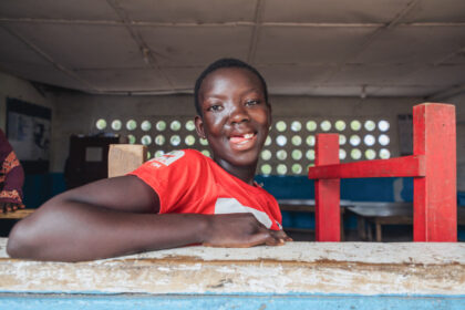 Facial tumor treatment courtesy Mercy Ship