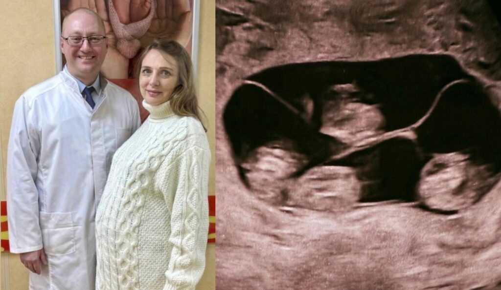 Russian Mum Defies 15-Million-to-One Odds to Give Birth to Identical Foursome