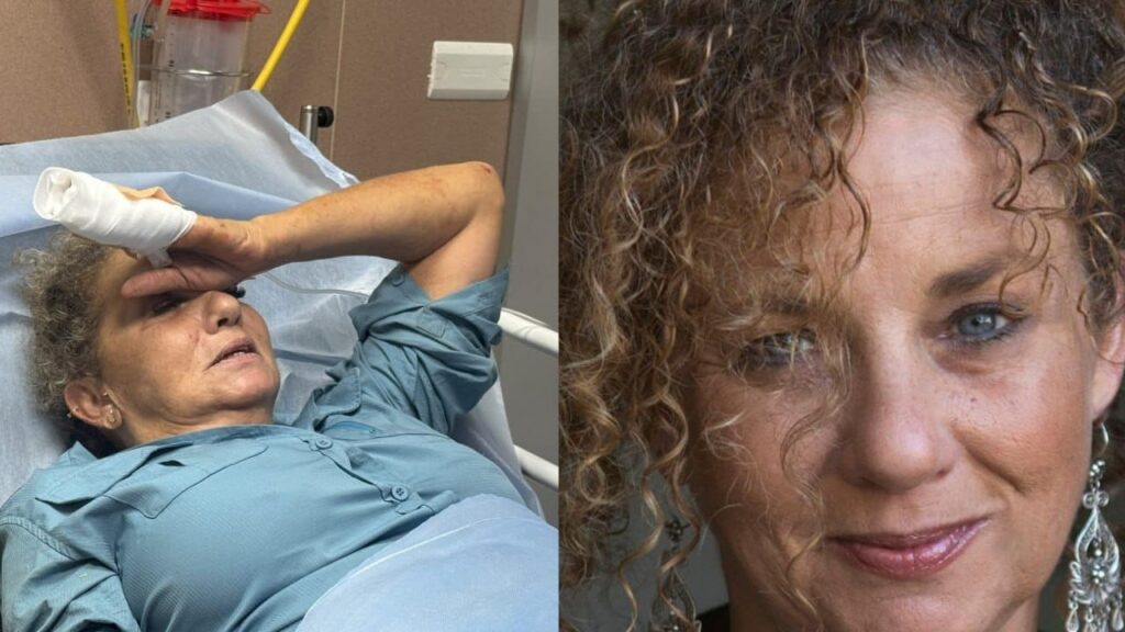 American Journalist Hospitalized After Attack by Israeli Settlers in West Bank